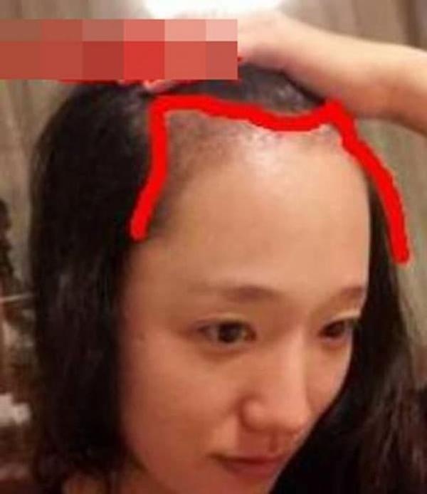 Xem tướng trán: Nhìn vài giây là biết ngay cuộc đời-3