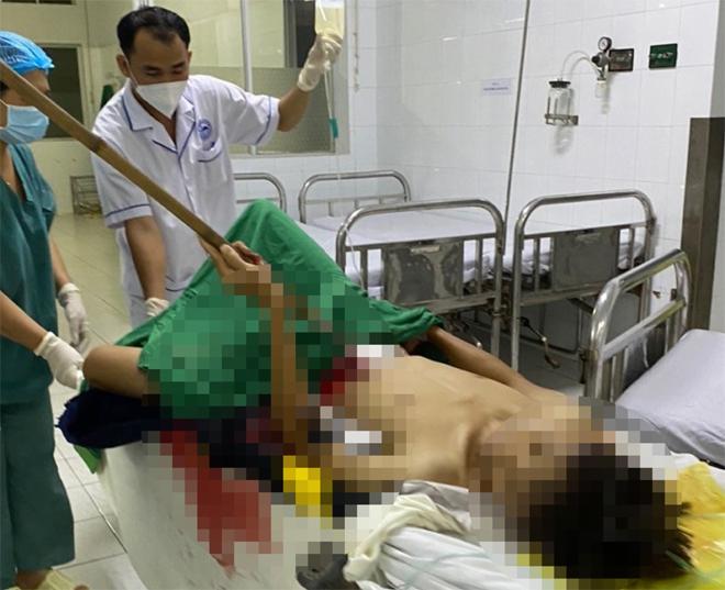Bé trai 12 tuổi bị dao cạo mủ cao su đâm xuyên bụng-3