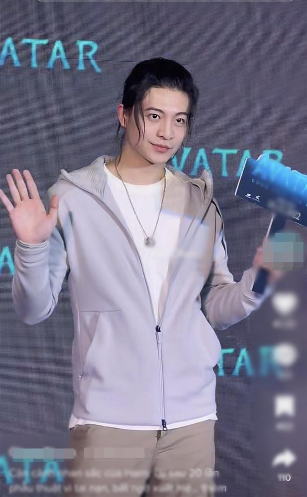 Không nhận ra Harry Lu sau tai nạn phá nát mặt, phẫu thuật 20 lần-1