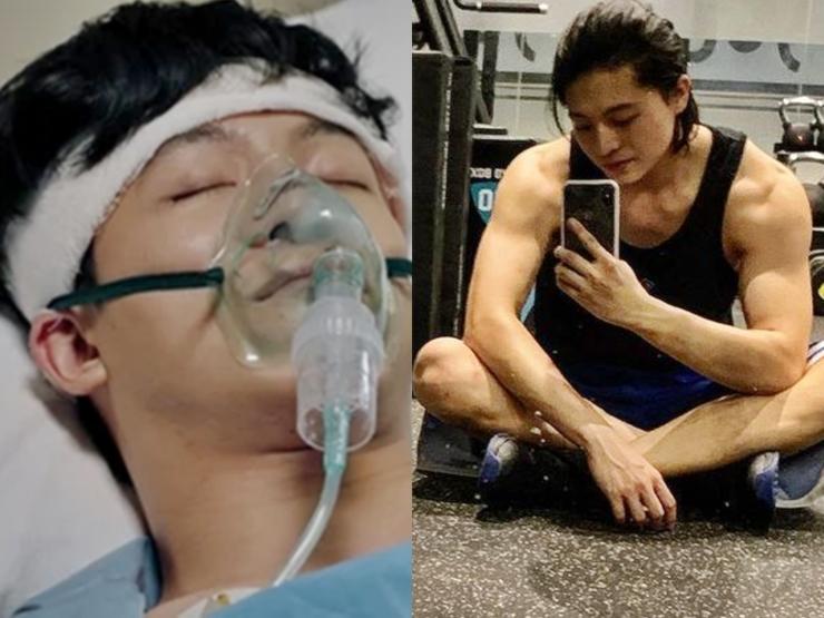 Không nhận ra Harry Lu sau tai nạn phá nát mặt, phẫu thuật 20 lần-8