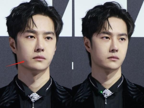 Vương Hạc Đệ - Bạch Lộc mặt trắng lệch tông, mỹ nhân đẹp nhất Diên Hi sần sùi mụn-11