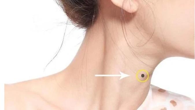 Nốt ruồi ở cổ, có lỗ tiền chôn: Dù nam hay nữ đều có số hưởng-2