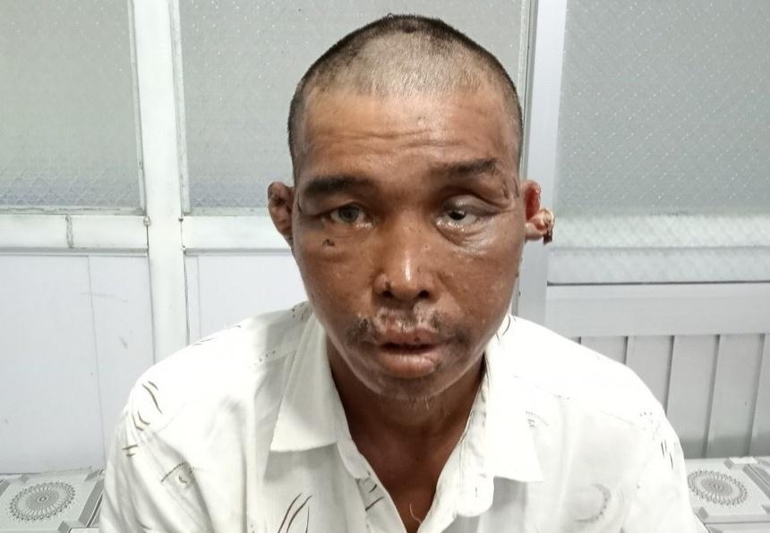 Xót xa lời kể ngư dân bị đánh thừa sống, thiếu chết trên tàu-3