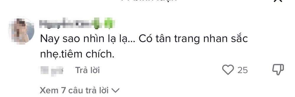Cát Phượng lộ nhan sắc đơ cứng, nghi trùng tu hậu có tình mới-9