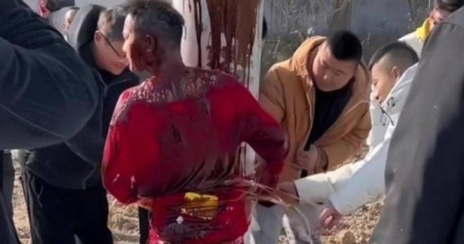 Chú rể bị lột đồ, trói cột, đổ nước tương lên người giữa thời tiết -7 độ C-1