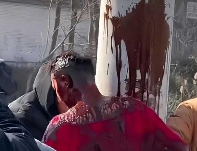 Chú rể bị lột đồ, trói cột, đổ nước tương lên người giữa thời tiết -7 độ C-2