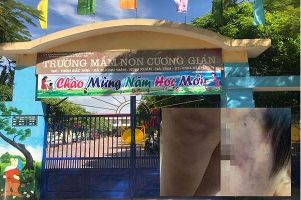 Chạy đua với thời gian cứu bé trai 10 tuổi rơi xuống trụ bê tông sâu 35m-3