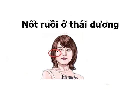 9 nốt ruồi tài lộc quý hơn vàng-2