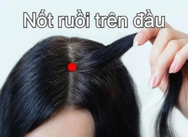 9 nốt ruồi tài lộc quý hơn vàng-4