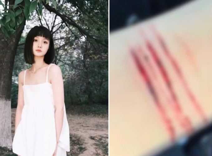 Tiểu tam cứa cổ tay vì bị chỉ trích cướp chồng Trương Gia Nghê-2