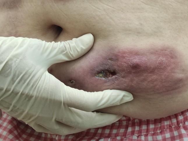 Quý bà tan nát cơ thể vì mê làm đẹp cấp tốc-1