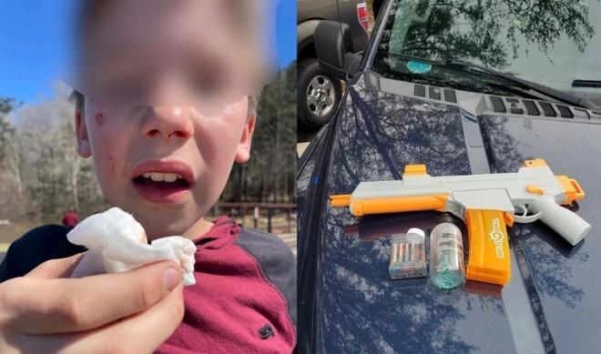 TikTok xuất hiện nhiều trào lưu độc hại trong năm 2022-4