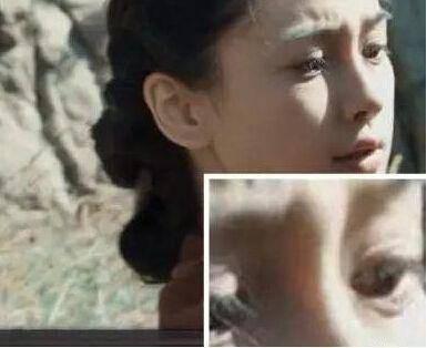 Sống mũi phát sáng liệu có phải bằng chứng dao kéo khó chối cãi?-2