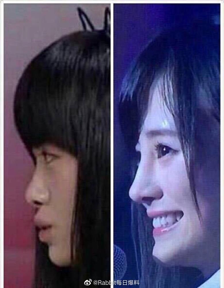 Sống mũi phát sáng liệu có phải bằng chứng dao kéo khó chối cãi?-4