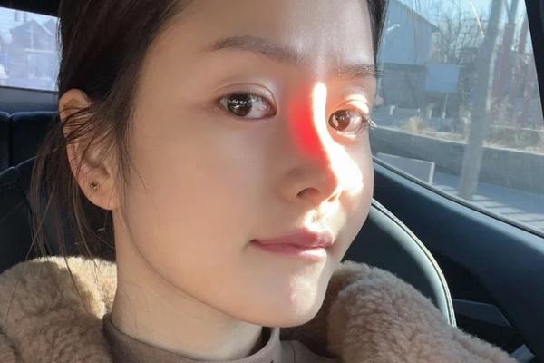 Sống mũi phát sáng liệu có phải bằng chứng dao kéo khó chối cãi?-1