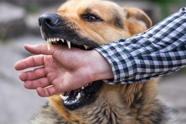 Sang hàng xóm chơi, bé 3 tuổi bị chó cắn rách mặt-2