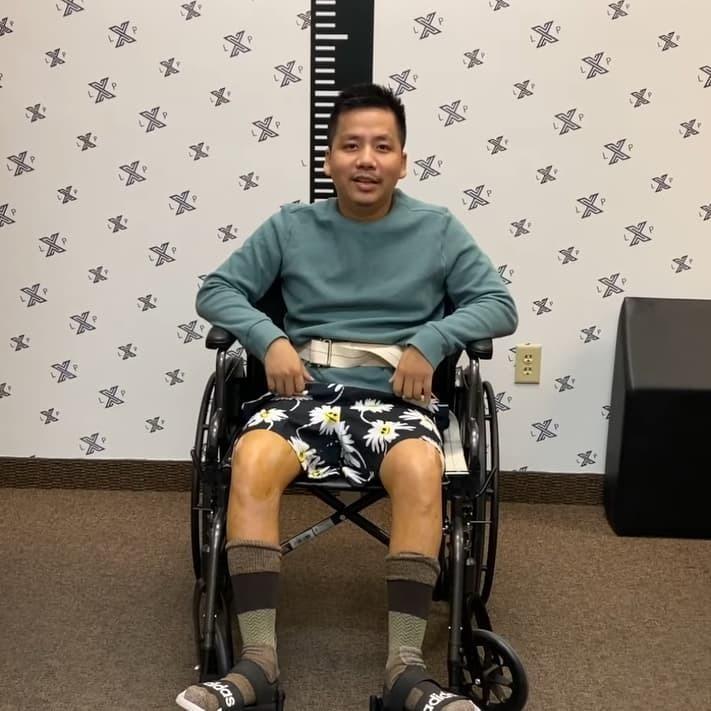 Bất ngờ ngoại hình hiện tại Khoa Pug sau khi chi 5 tỷ kéo dài chân-5