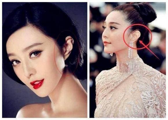 Sự khác biệt giữa tai của người nghèo và tai của người giàu-6