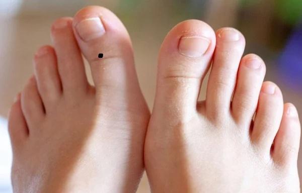 Người có nốt ruồi ở lòng bàn chân cả đời gặp hung hóa cát-2