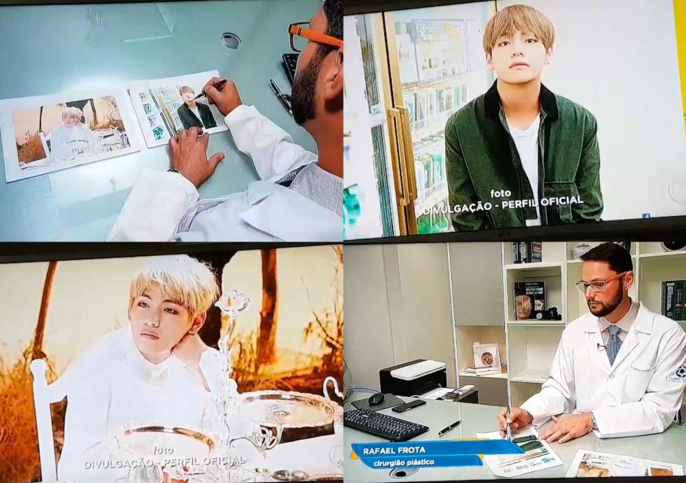 Giá phải trả để có gương mặt lý tưởng như V (BTS)-5