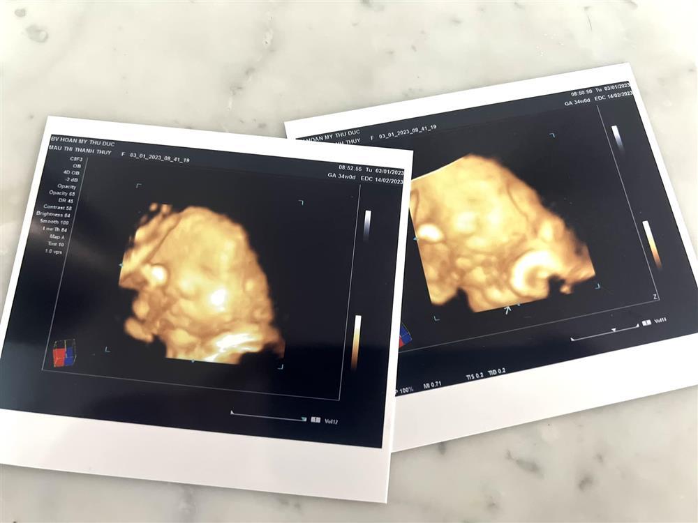 Showbiz Việt ngày 6/1: Bạn trai lo Mâu Thủy có dấu hiệu sinh sớm-2