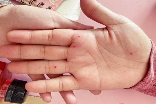 Kiếm bộn tiền nhờ dịch vụ xăm nốt ruồi phong thủy ngày cận Tết-2