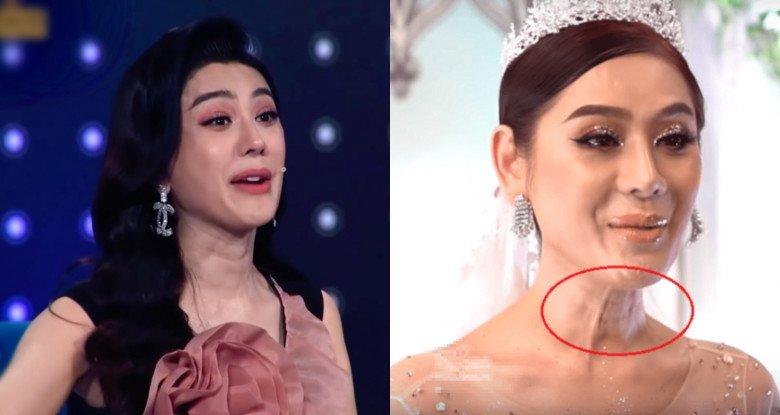 Lâm Khánh Chi lộ dấu hiệu lão hóa dù bỏ 1 tỷ đồng tân trang-11