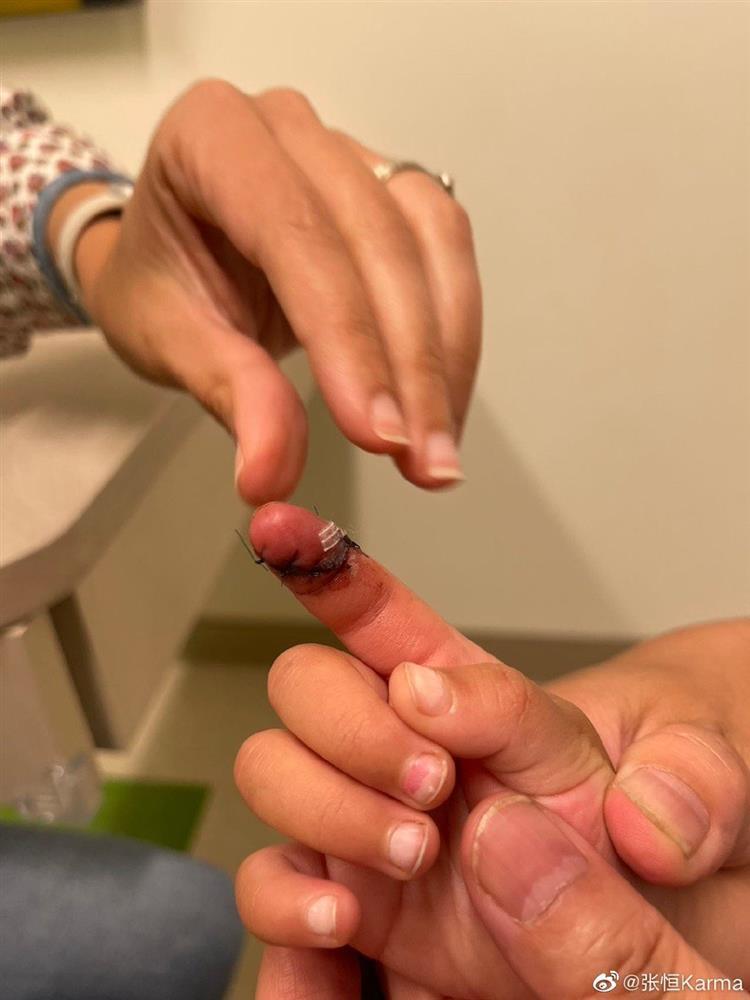 Trương Hằng báo án Trịnh Sảng tội hình sự-1