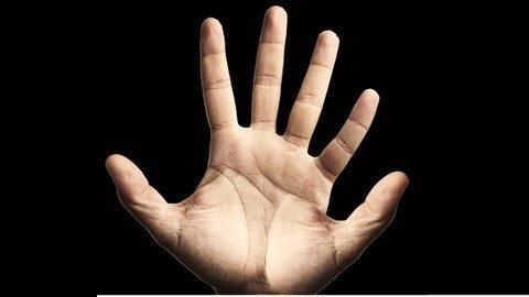 Xôn xao người có tay 6 ngón đều chằn chặn, họa hung cát ra sao?-4