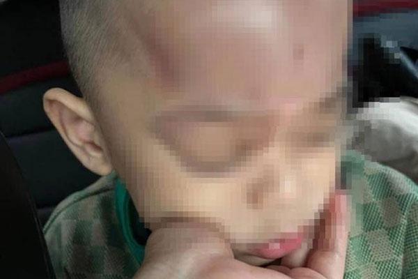 Xác minh thông tin trẻ bị bạo hành ở trường mầm non tại Đà Nẵng-1