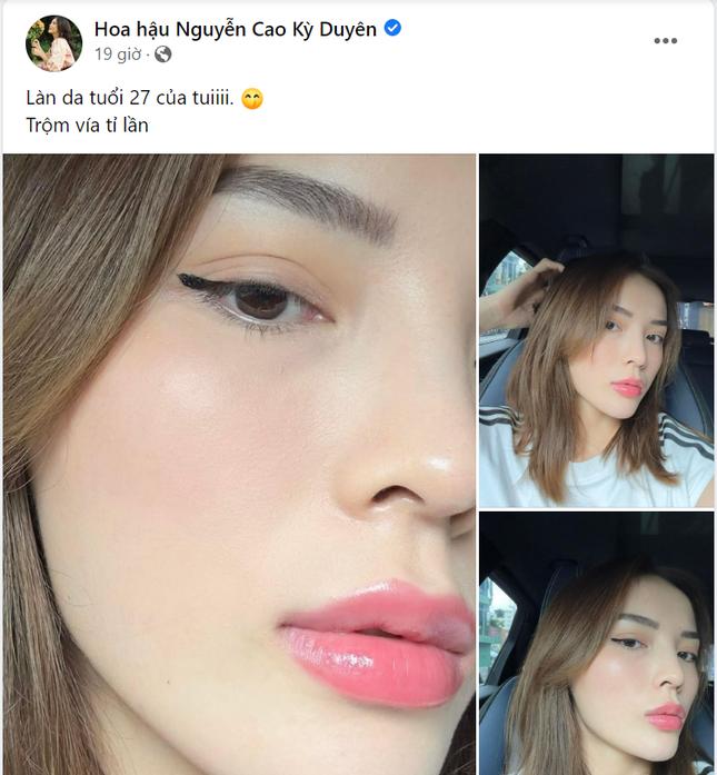 Khoe da tuổi 27, Kỳ Duyên bị soi ra chi tiết hài hước trên mặt-1