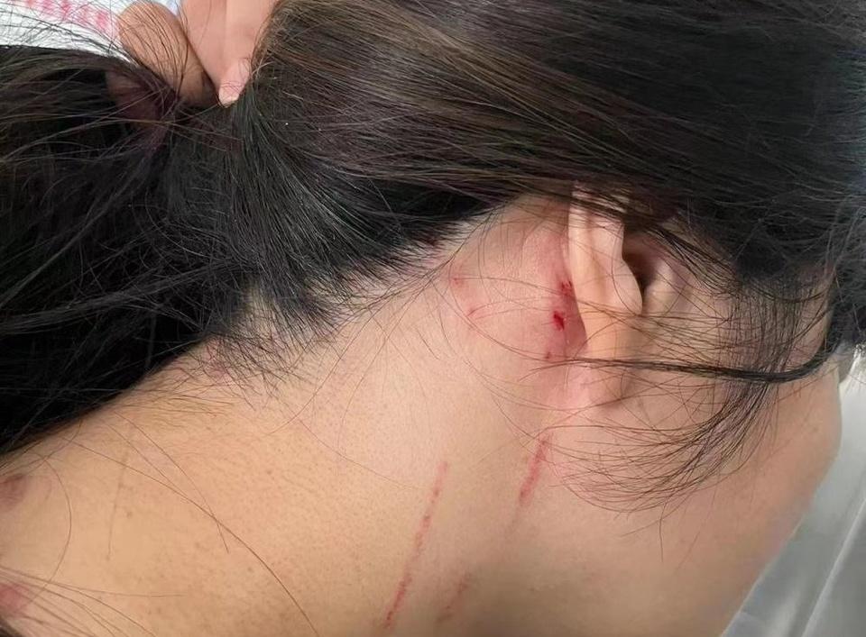Cô gái Trung Quốc bị đánh đập vì từ chối đi xem mắt-1