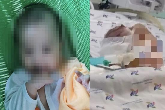 Xót xa lời kể mẹ bé 6 tháng tuổi bị bạo hành dập não
