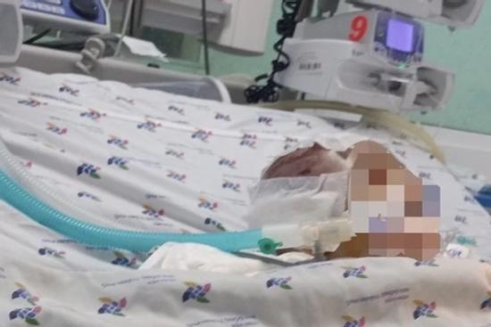 Vụ bé 6 tháng tuổi bị đánh dập não: Nạn nhân thương tích 99%