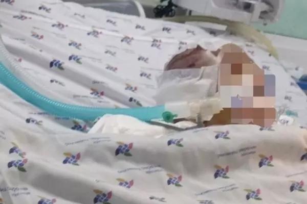 Luật sư lên tiếng vụ bé trai 6 tháng tuổi bị đánh dập não-1