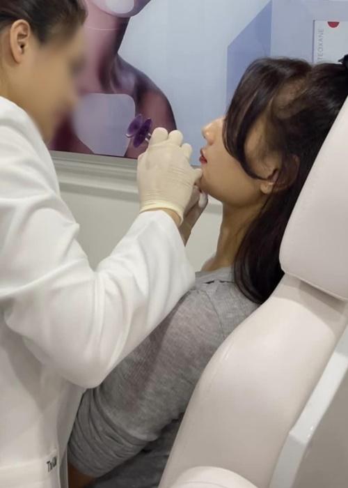 Lê Thúy tiêm filler cải thiện khuôn mặt bị ví như đàn ông-6
