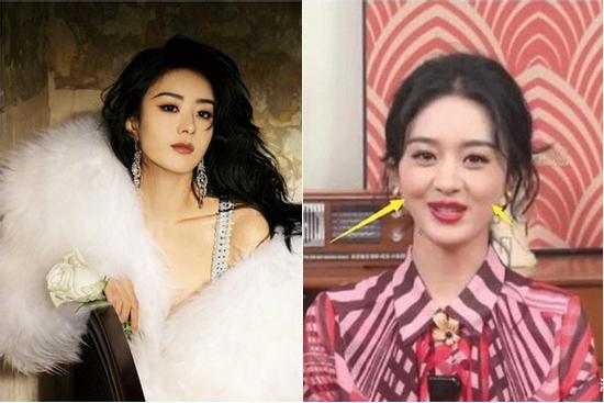 Triệu Lệ Dĩnh bị nghi lộ di chứng phẫu thuật thẩm mỹ