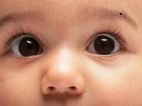 Trẻ có nốt ruồi 3 vị trí này tương lai sáng, phú quý hơn người-2