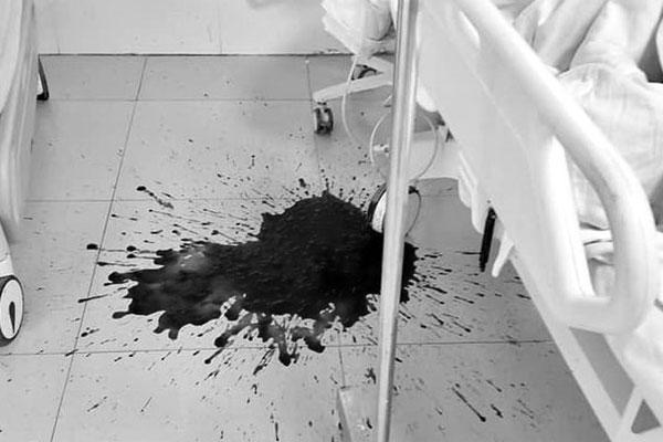 Người đàn ông 3 lần nôn ra máu sau bữa rượu ngày Tết-1