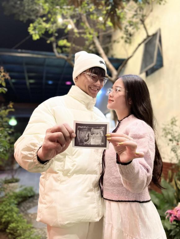 Diễn viên Anh Tú chuẩn bị đón con đầu lòng sau 1 năm kết hôn-1