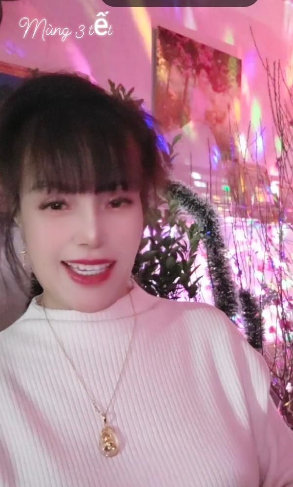 Cô dâu 62 tuổi lộ ngoại hình lạ lẫm sau biến chứng thẩm mỹ-2