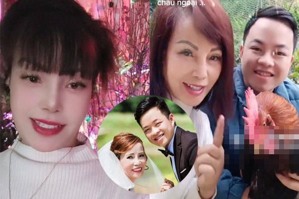 Nghiện tiêm filler, người phụ nữ bị mục nát và rụng một bên mũi-4