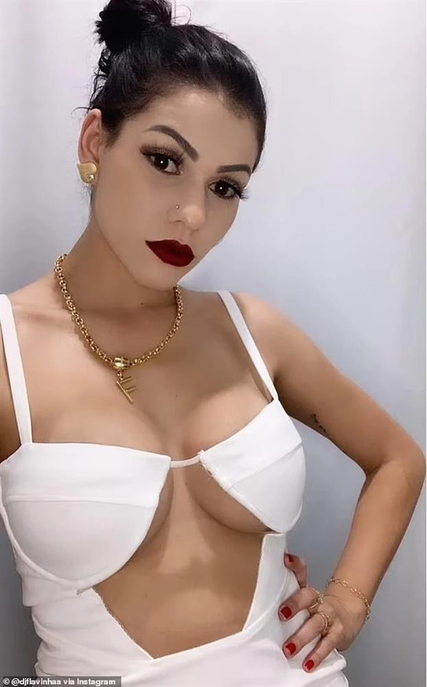 Nữ DJ bị bỏng vì cầm ngược súng bắn pháo giấy-3