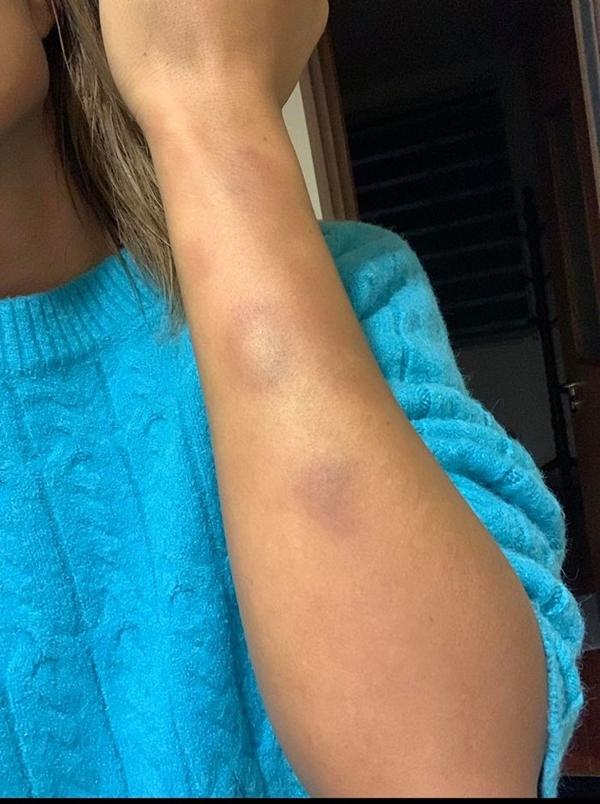 Thúy Ngân và dàn mỹ nhân Việt nát người khi vào vai hành động-2