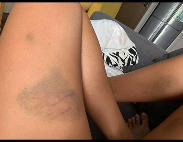 Thúy Ngân và dàn mỹ nhân Việt nát người khi vào vai hành động-3