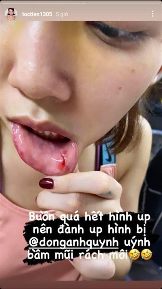 Thúy Ngân và dàn mỹ nhân Việt nát người khi vào vai hành động-8