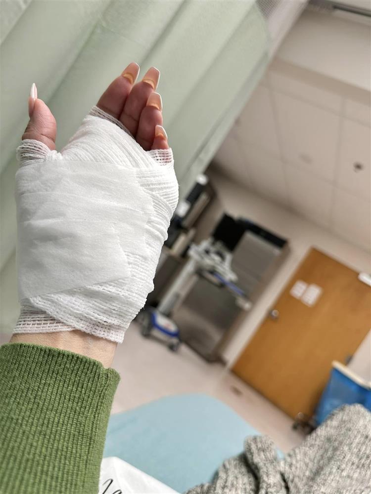 Bằng Kiều động viên khi vợ cũ bị thương, khâu 14 mũi-3