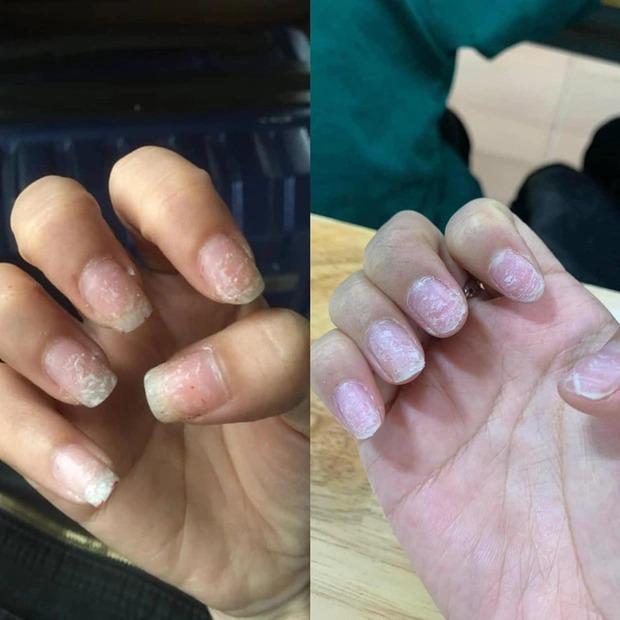Hoảng hồn với những bộ nail nham nhở sau khi tháo móng giả chơi Tết-1