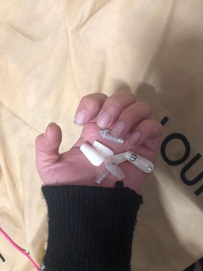 Hoảng hồn với những bộ nail nham nhở sau khi tháo móng giả chơi Tết-2