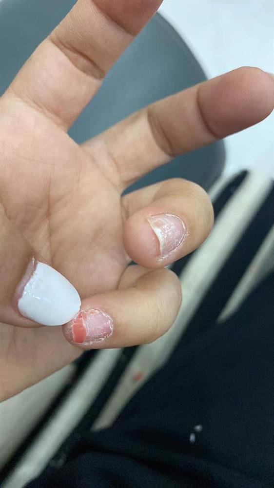 Hoảng hồn với những bộ nail nham nhở sau khi tháo móng giả chơi Tết-5